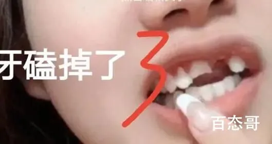 女子阳后一周锻炼晕倒摔断3颗牙 这