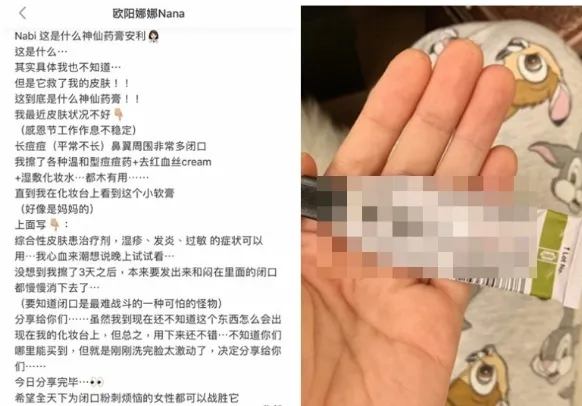 欧阳娜娜推荐祛痘药膏，却被医师纠正